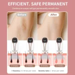 دستگاه لیزر خانگی IPL دیود فوتون 2025 با طراحی پرتابل و فناوری خنک‌کننده