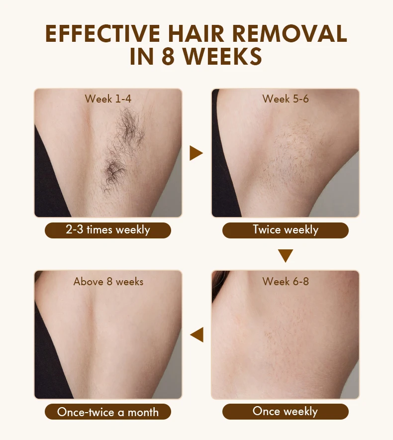 کاربر در حال استفاده از دستگاه لیزر خانگی IPL برای اپیلاسیون دست و پا